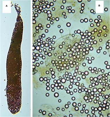 Microplastic Consumption and Its Effect on Respiration Rate and Motility of Calanus helgolandicus From the Marmara Sea